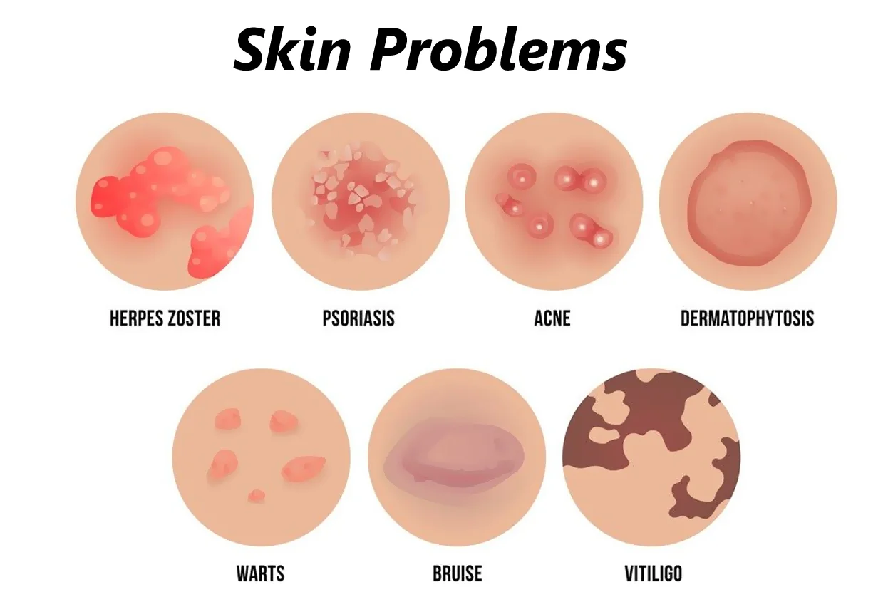 Skin Problems